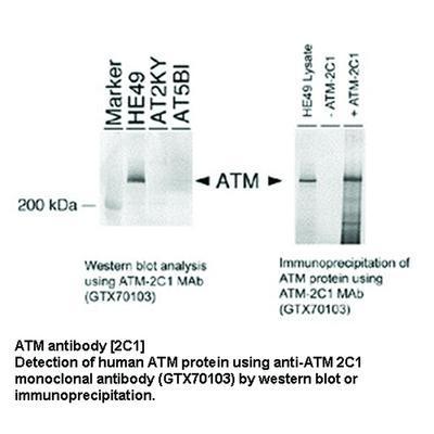 ATM antibody [2C1], GeneTex