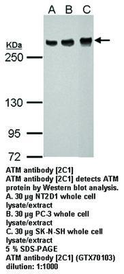 ATM antibody [2C1], GeneTex