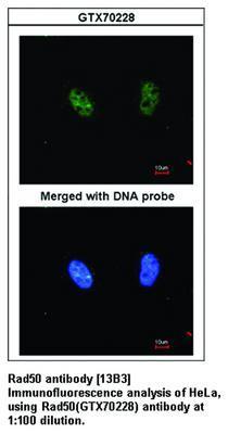 Rad50 antibody [13B3], GeneTex