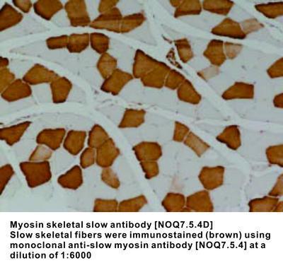 Myosin skeletal slow antibody [NOQ7.5.4D], GeneTex