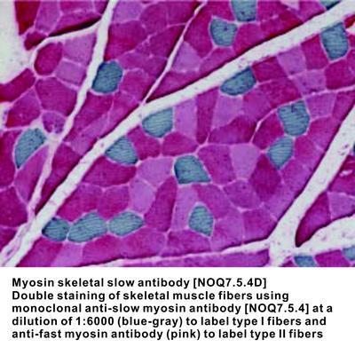 Myosin skeletal slow antibody [NOQ7.5.4D], GeneTex