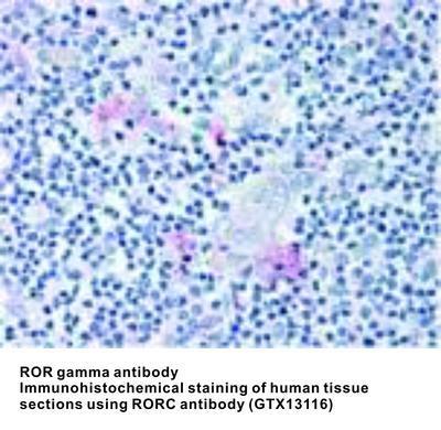 ROR gamma antibody (Modulating Domain) - Rabbit Polyclonal - IHC-P - 25µg, GeneTex