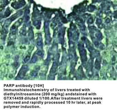 PARP antibody [10H], GeneTex