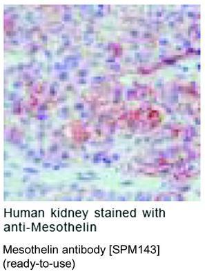 Mesothelin antibody [SPM143] (ready-to-use), GeneTex