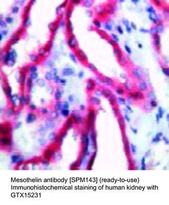 Mesothelin antibody [SPM143] (ready-to-use), GeneTex