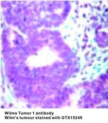 Wilms Tumor 1 antibody - 500µl, GeneTex