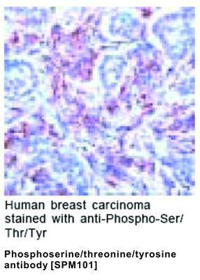 Phosphoserine/threonine/tyrosine antibody [SPM101], GeneTex