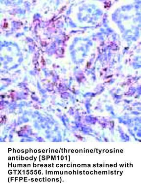 Phosphoserine/threonine/tyrosine antibody [SPM101], GeneTex