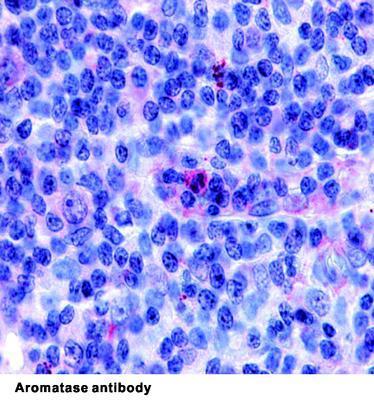 Aromatase antibody, GeneTex