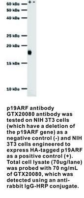 p19ARF antibody, GeneTex