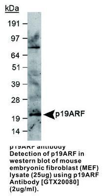 p19ARF antibody, GeneTex