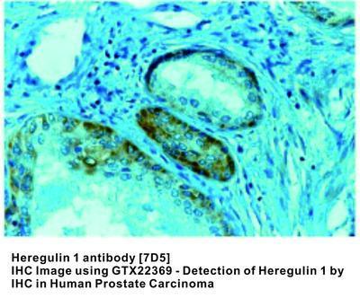 Heregulin 1 antibody [7D5], GeneTex