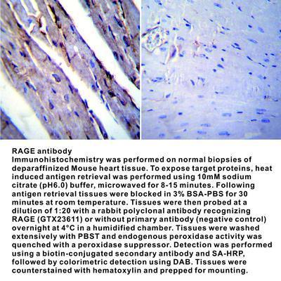 RAGE antibody - 100µg, GeneTex