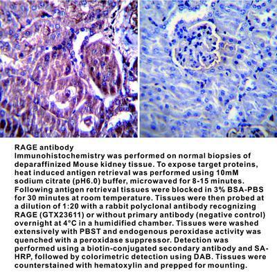 RAGE antibody - 100µg, GeneTex