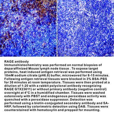 RAGE antibody - 100µg, GeneTex