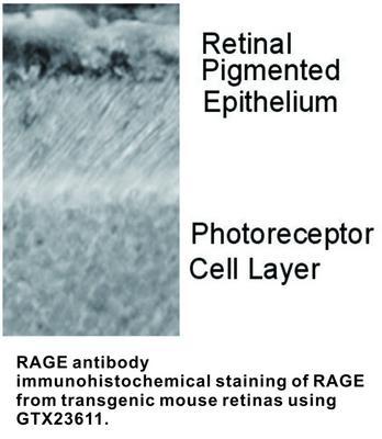 RAGE antibody - 100µg, GeneTex