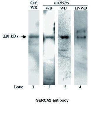 SERCA2 antibody, GeneTex