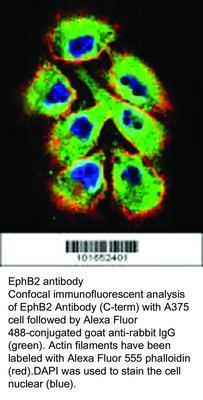 EphB2 antibody - Rabbit Polyclonal - ELISA, ICC/IF, IHC-P, WB - 100µg, GeneTex