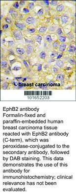 EphB2 antibody - Rabbit Polyclonal - ELISA, ICC/IF, IHC-P, WB - 100µg, GeneTex