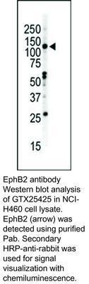 EphB2 antibody - Rabbit Polyclonal - ELISA, ICC/IF, IHC-P, WB - 100µg, GeneTex