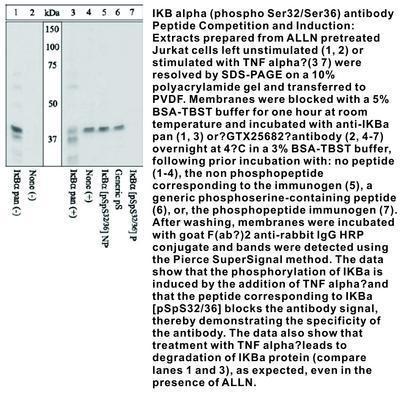 IKB alpha (phospho Ser32/Ser36) antibody, GeneTex