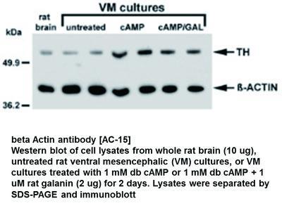 beta Actin antibody [AC-15], GeneTex