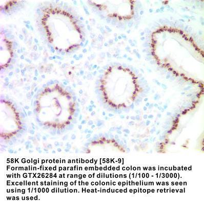 58K Golgi protein antibody [58K-9], GeneTex