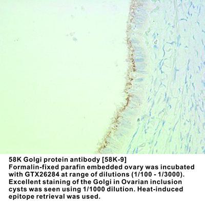 58K Golgi protein antibody [58K-9], GeneTex