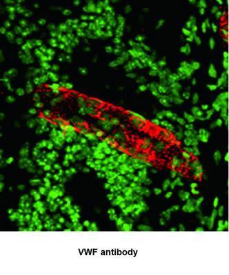 VWF antibody - 100µl, GeneTex