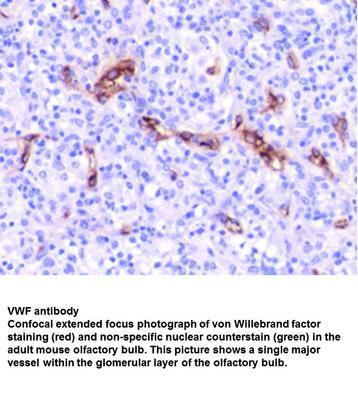 VWF antibody - 100µl, GeneTex