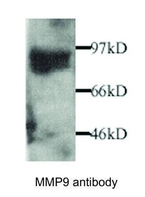 MMP9 antibody, GeneTex