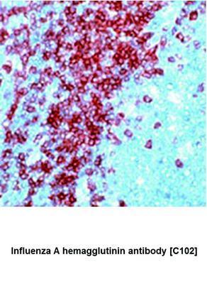 Influenza A hemagglutinin antibody [C102], GeneTex