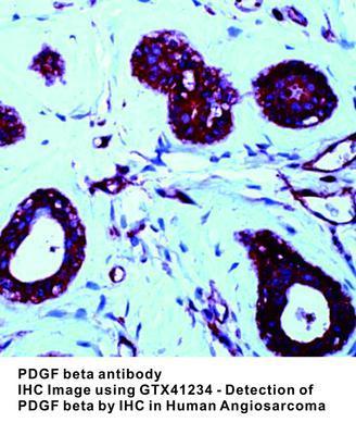 PDGF beta antibody, GeneTex