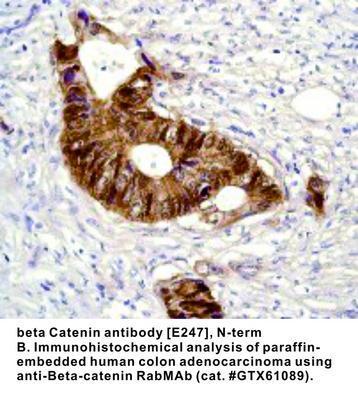 beta Catenin antibody [E247], N-term, GeneTex