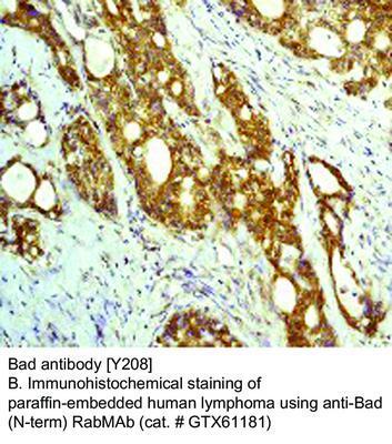 Bad antibody [Y208], GeneTex