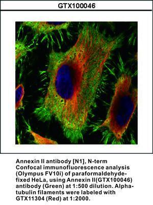 Annexin II antibody [N1], N-term, GeneTex