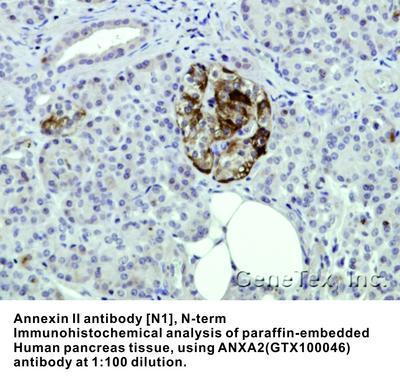 Annexin II antibody [N1], N-term, GeneTex