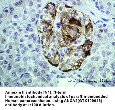 Annexin II antibody [N1], N-term, GeneTex