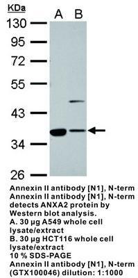 Annexin II antibody [N1], N-term, GeneTex