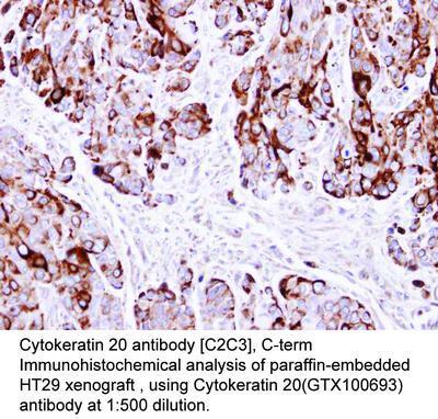 Cytokeratin 20 antibody [C2C3], C-term, GeneTex