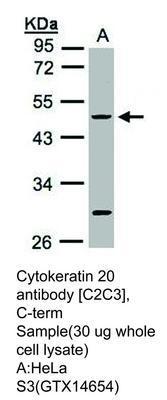 Cytokeratin 20 antibody [C2C3], C-term, GeneTex