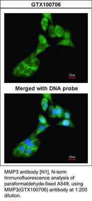 MMP3 antibody [N1], N-term, GeneTex