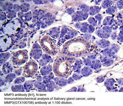 MMP3 antibody [N1], N-term, GeneTex