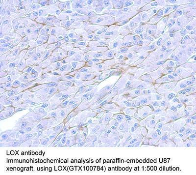 LOX antibody, GeneTex