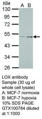 LOX antibody, GeneTex