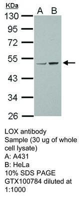 LOX antibody, GeneTex