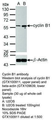 Cyclin B1 antibody, GeneTex