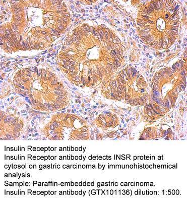 Insulin Receptor antibody, GeneTex