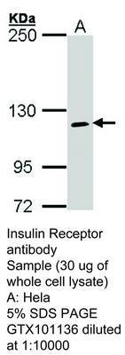 Insulin Receptor antibody, GeneTex