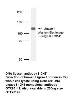 DNA ligase I antibody [10H5], GeneTex